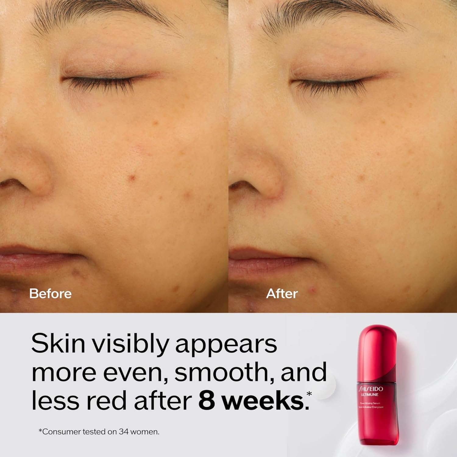 Shiseido Ultimune Power Infusing Serum - Breakthrough Lightweight Face Serum - Boosts Radiance & Improves Visible Signs of Aging - All Skin Types - Non-Comedogenic
