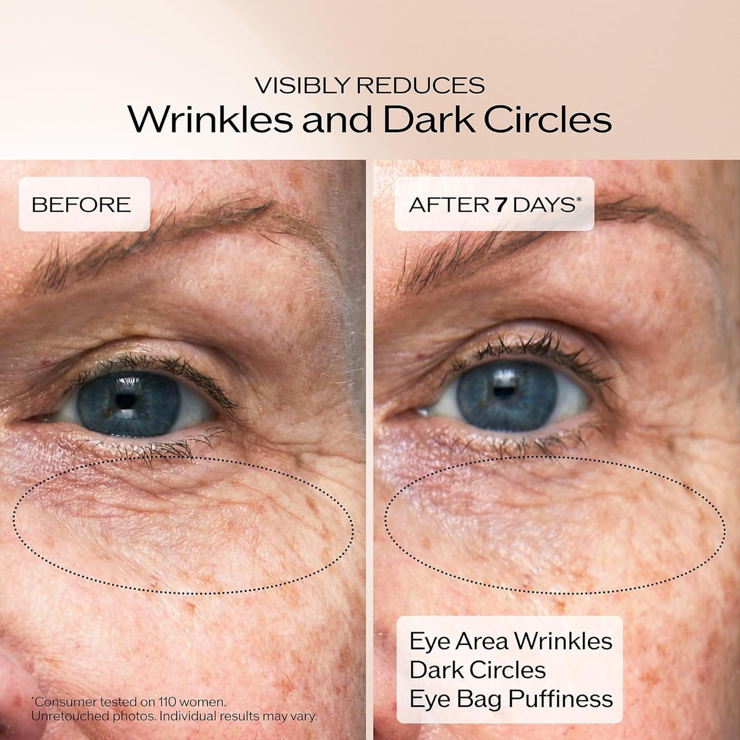 Shiseido Benefiance Wrinkle Smoothing Eye Cream - 15 mL - Visibly Improves Five Types of Eye Wrinkles, Dark Circles & Puffiness - 48-HR Hydration - All Skin Types - Non-Comedogenic