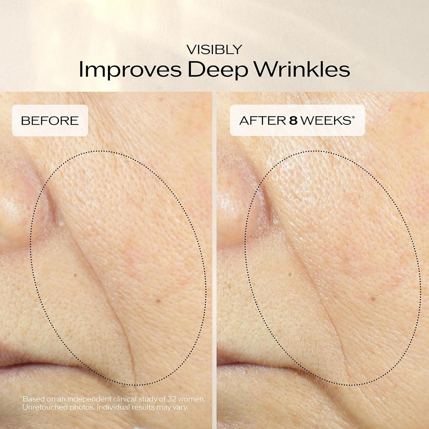 Shiseido Vital Perfection Cream - Anti-Aging Moisturizer for Normal to Dry Skin - Visibly Lifts & Firms